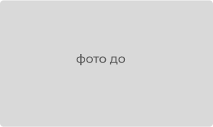 Фото до